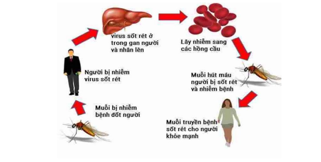 Hướng dẫn sơ đồ truyền bệnh sốt rét hiệu quả và an toàn nhất