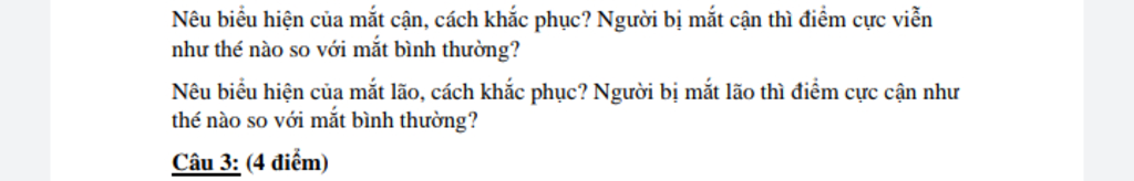 Những biểu hiện chính của tật cận thị là gì?
