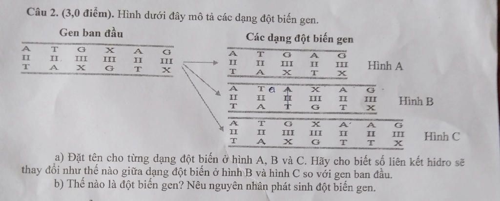 Tổng hợp 10 bệnh do đột biến gen phổ biến thường gặp ở người